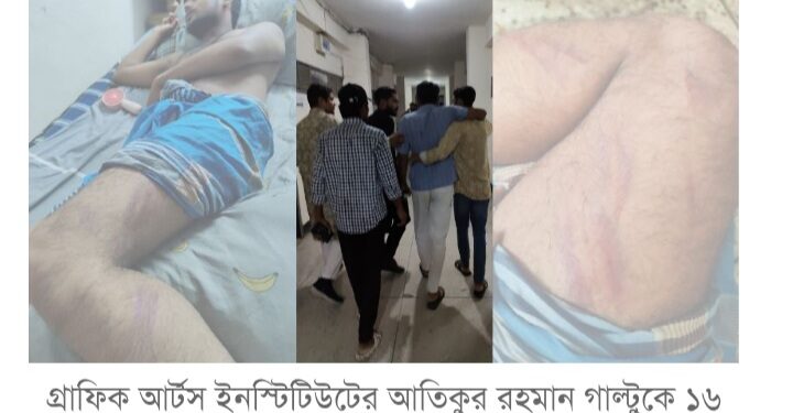 ছাত্রলীগ ট্যাগ দিয়ে শিক্ষার্থী নির্যাতন করছে ছাত্রদল  মাহী